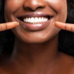 Professional Vs Over the Counter Teeth Whitening