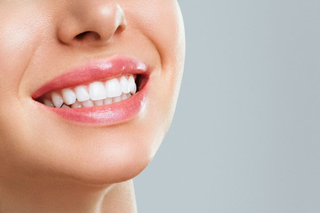 Teeth Whitening in Penticton This Summer: A Brighter Smile