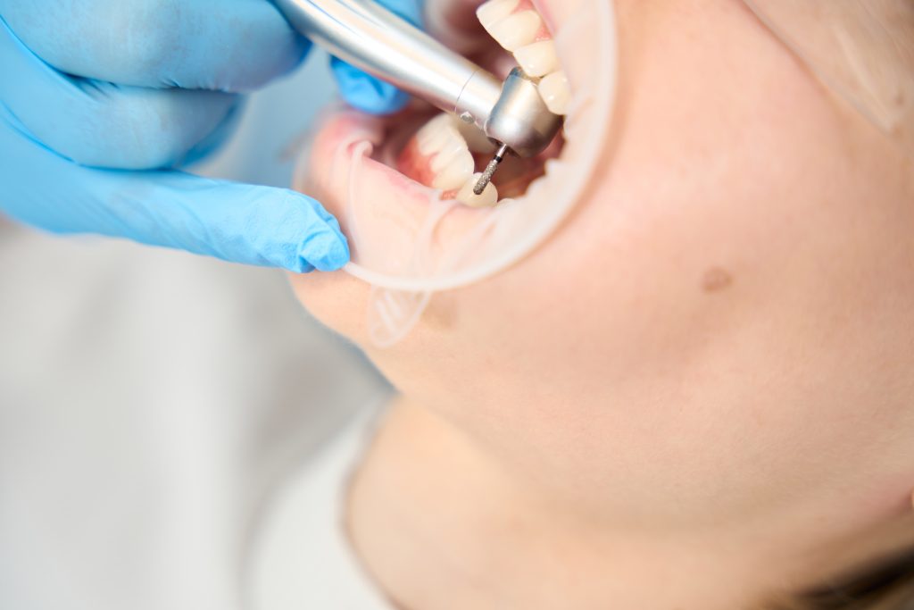 Patient receiving dental care in Penticton