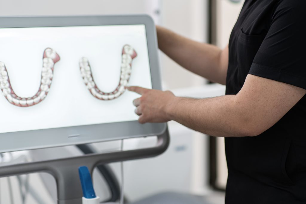 Invisalign in Canada