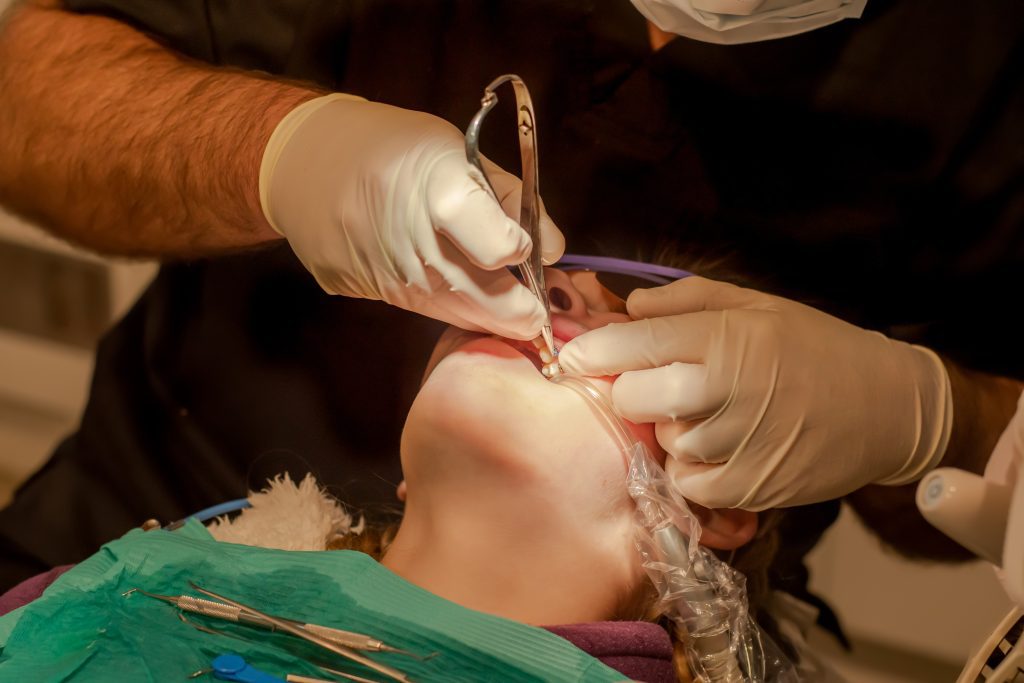 Jaw pain after dental work  