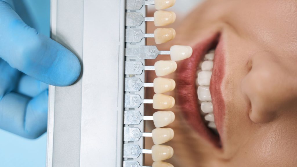 White Spots on Teeth: Causes, Prevention & Treatment