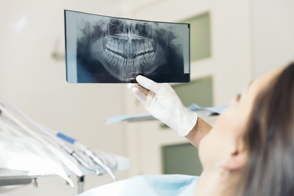 Detailed view of an implant crown secured to a dental implant as part of a restorative dental procedure